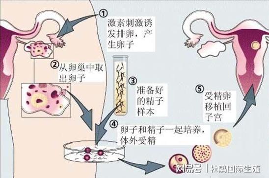 供卵的孩子和母亲没有血缘吗【非血缘母子:供卵孩子的成长之路】